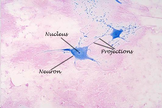 Multipolar Neurons