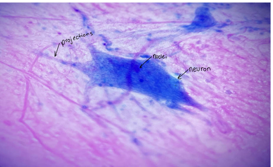 Multipolar Neurons