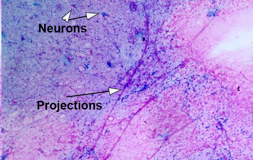 Multipolar Neurons