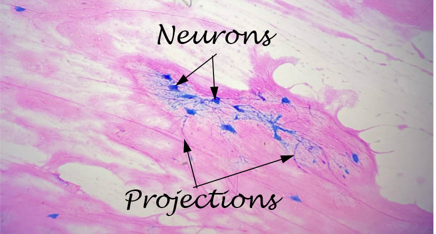 Multipolar Neurons