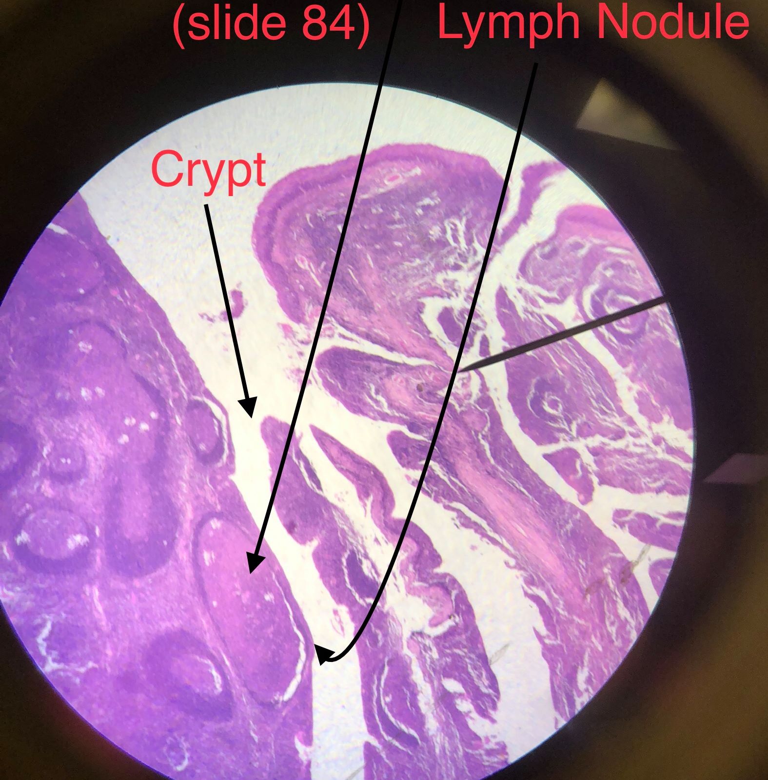 tonsil