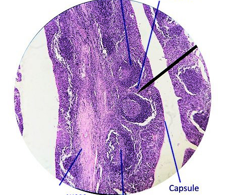 tonsil