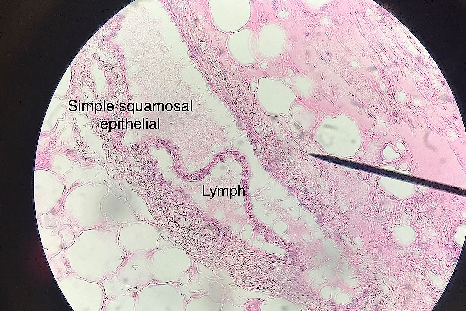 lymph vessel