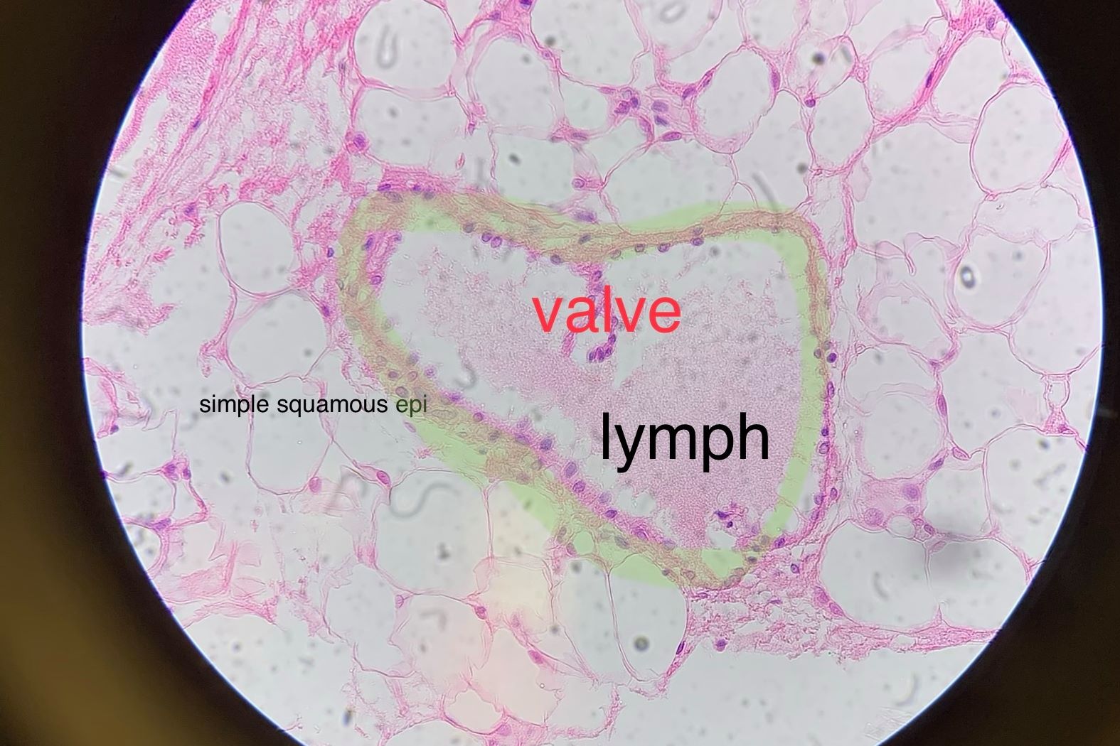 lymph vessel