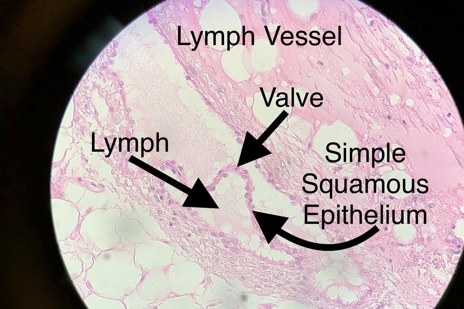 lymph vessel