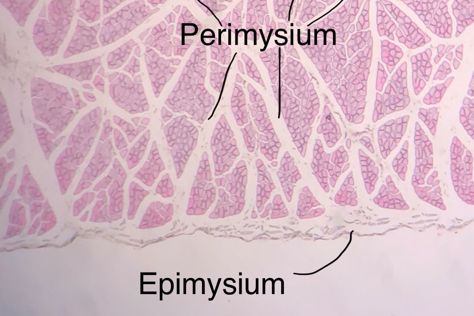 Skeletal Muscle