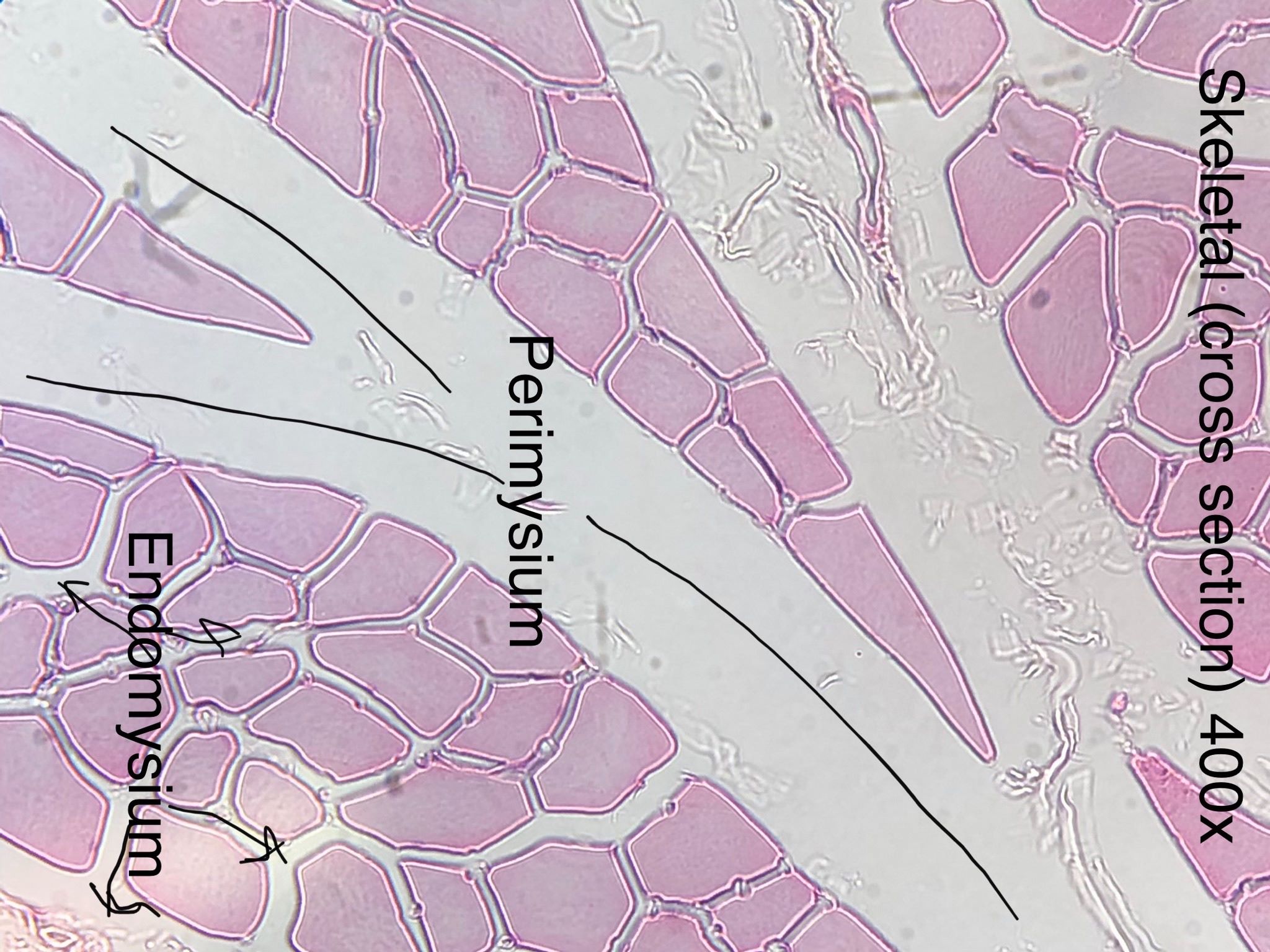 Skeletal Muscle