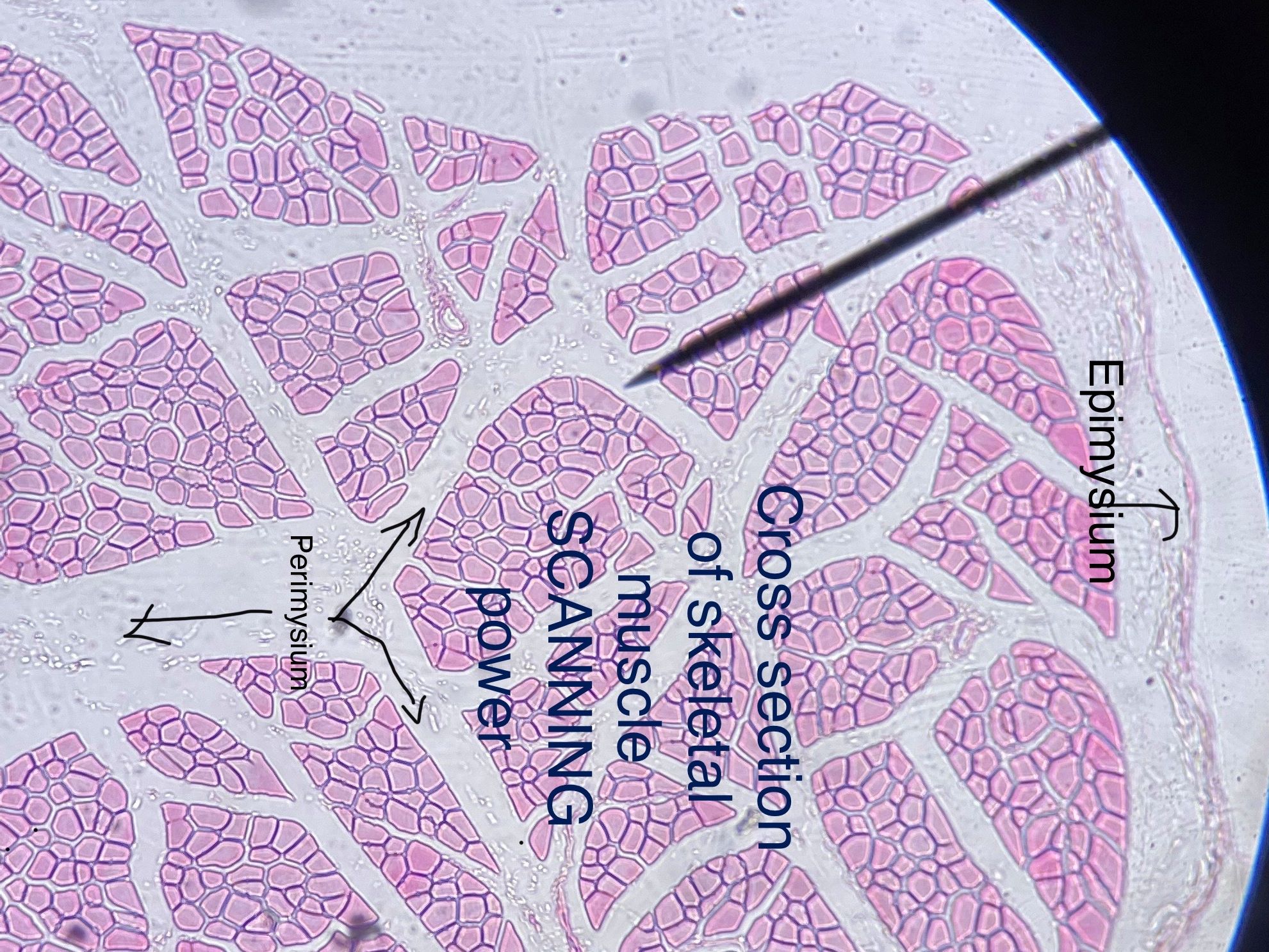 Skeletal Muscle