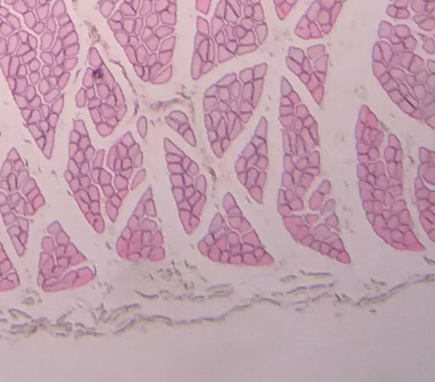 Skeletal Muscle