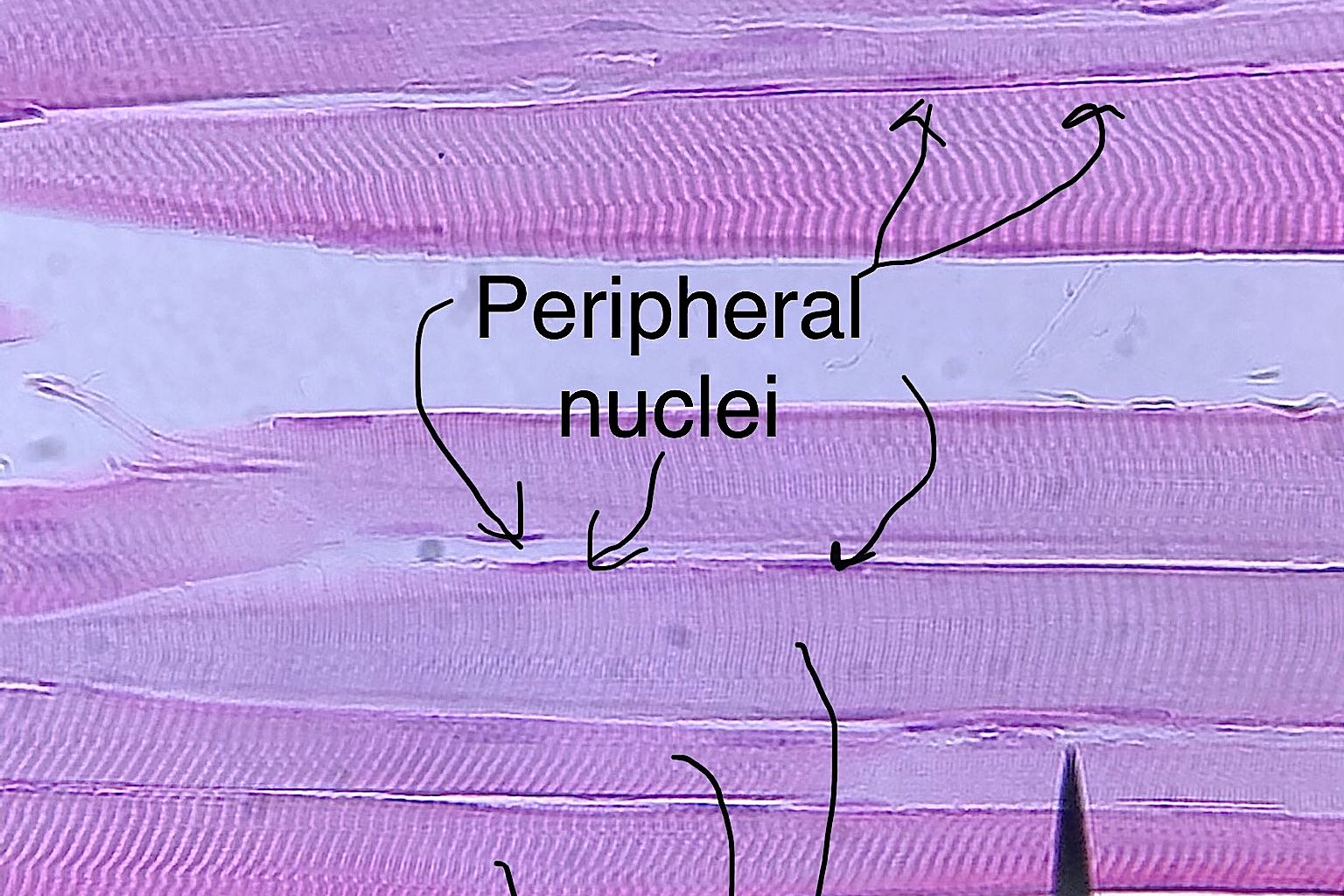 Skeletal Muscle