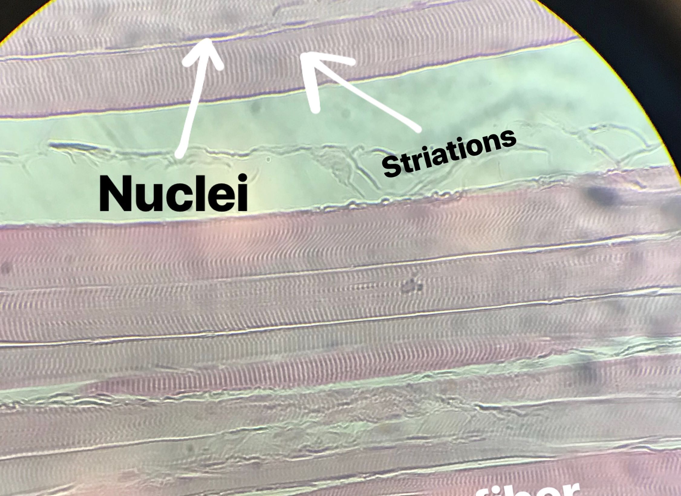 Skeletal Muscle