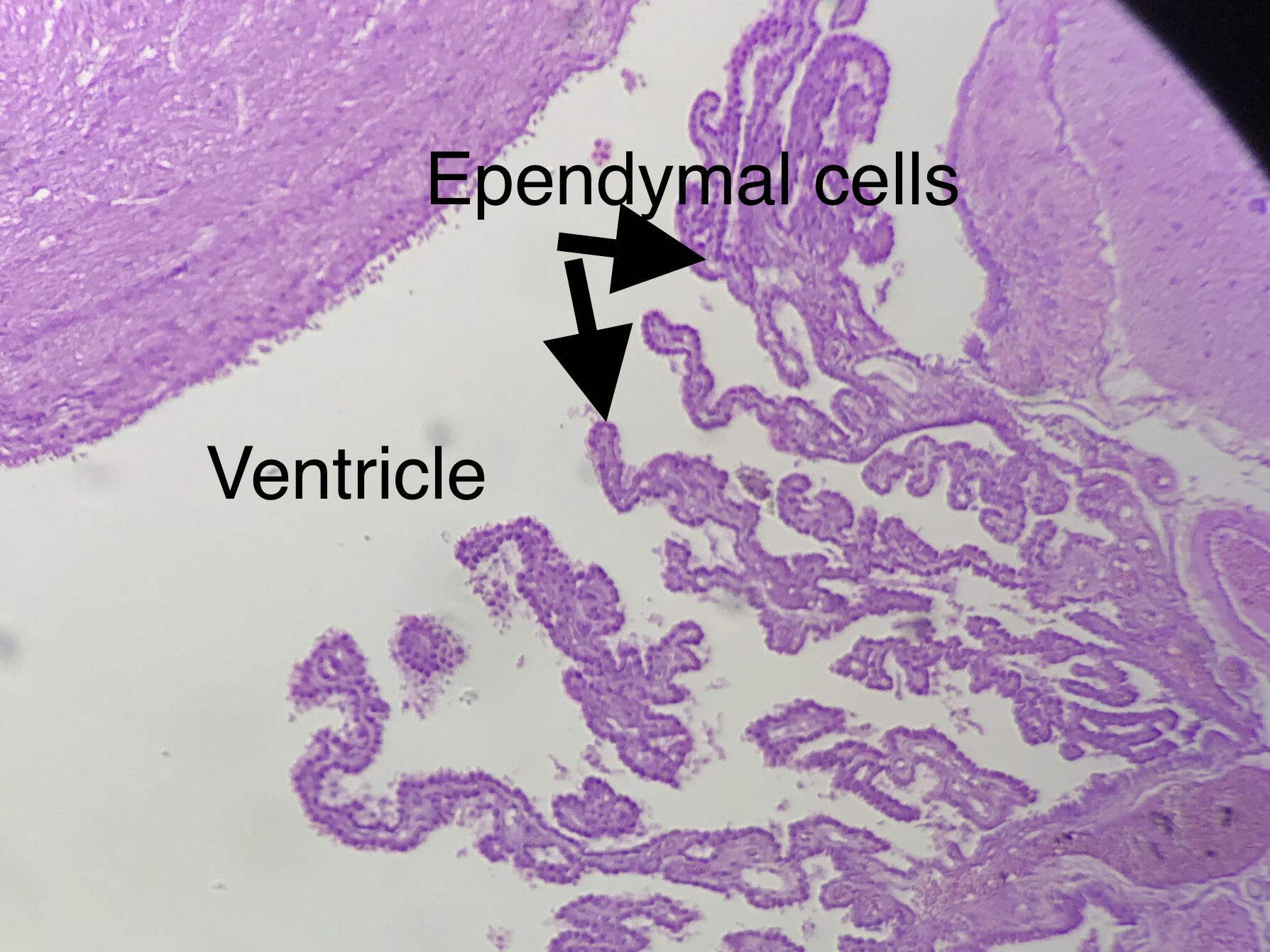 Pyramidal Neuron