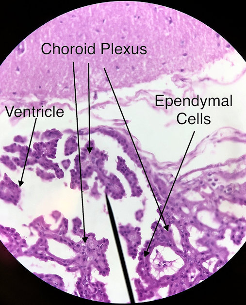 Pyramidal Neuron