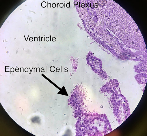 Pyramidal Neuron