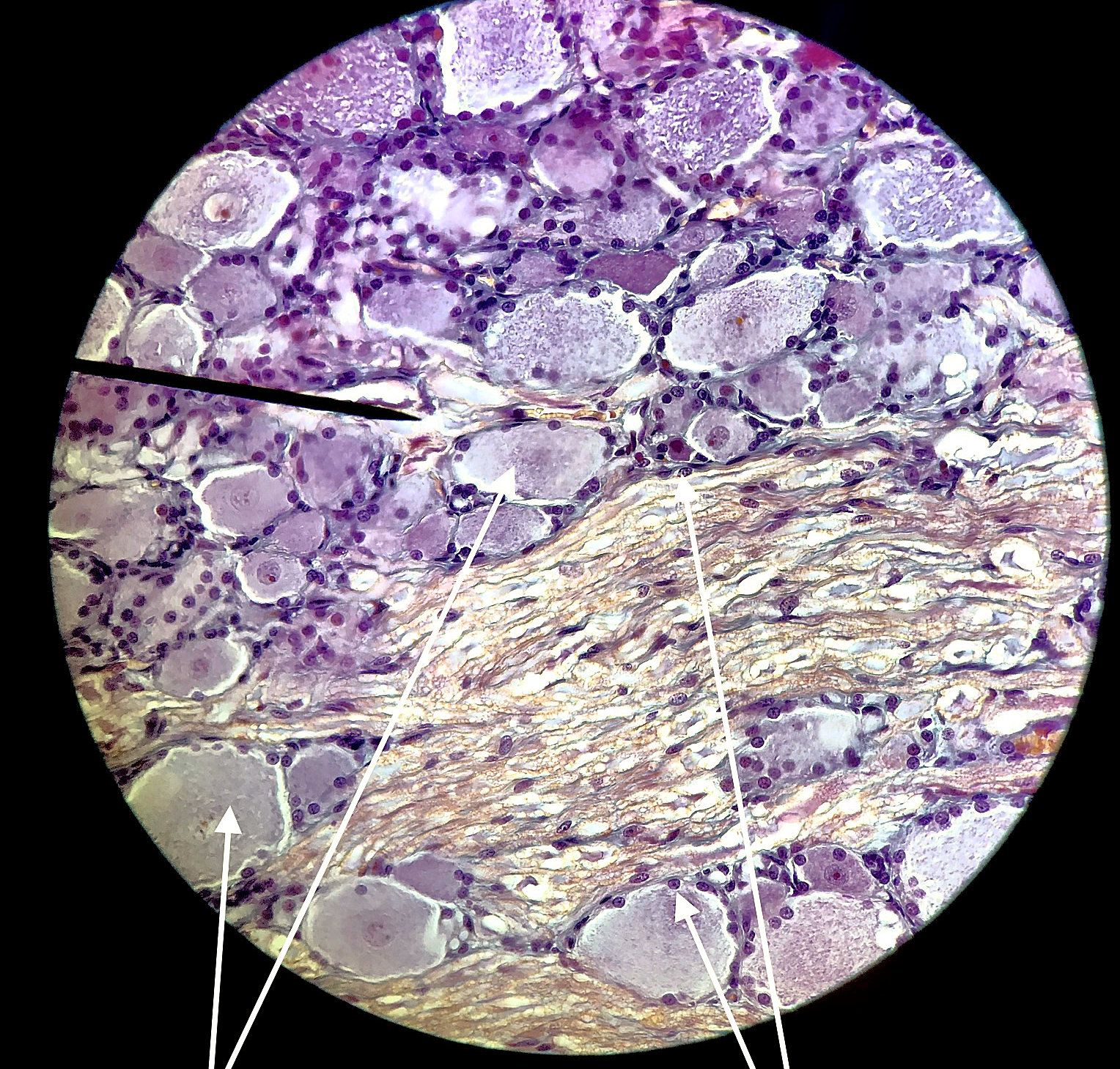 Pyramidal Neuron