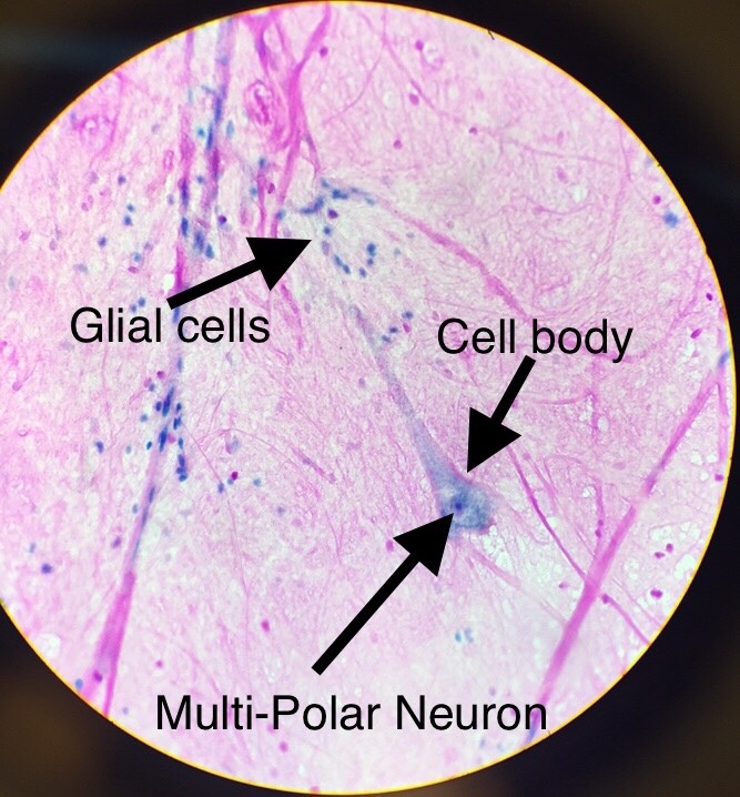 Multiipoloar Neuron