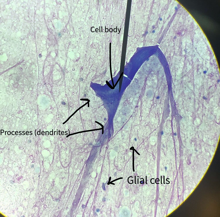 Multiipoloar Neuron