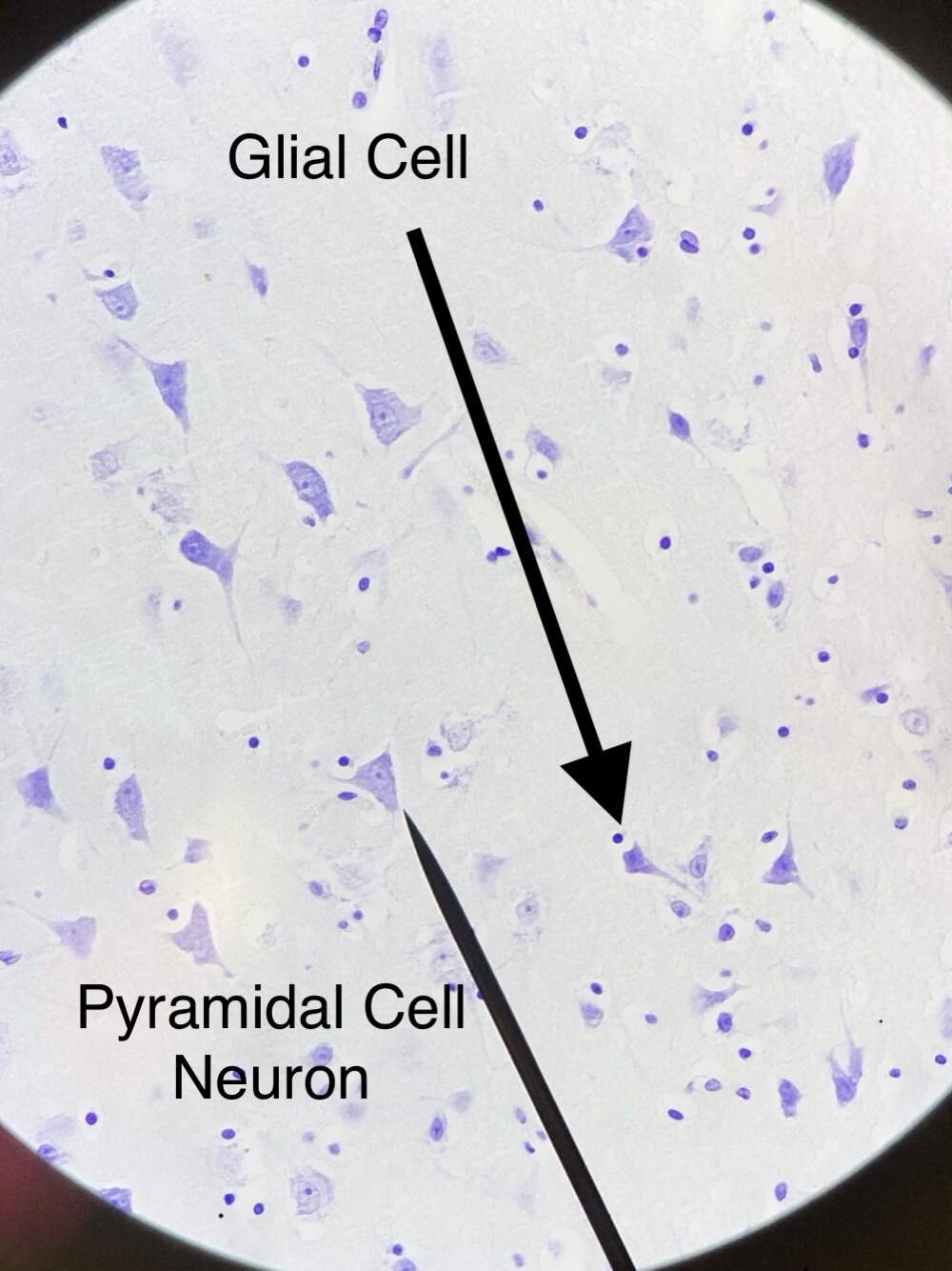 Pyramidal Neuron