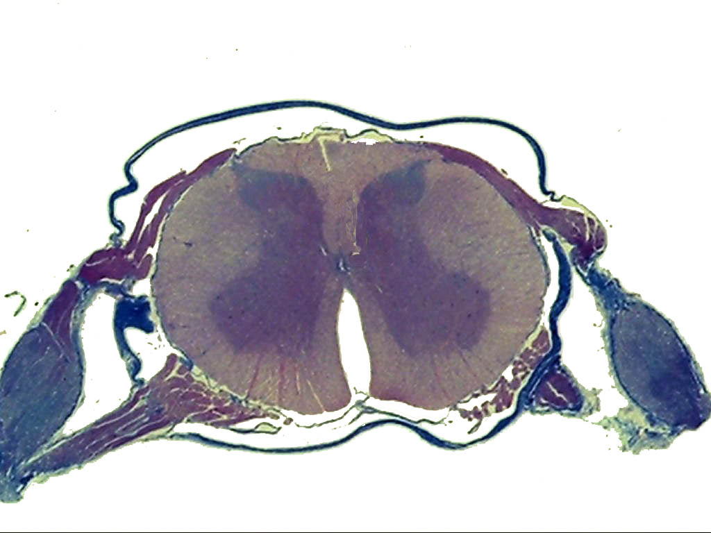 Pyramidal Neuron