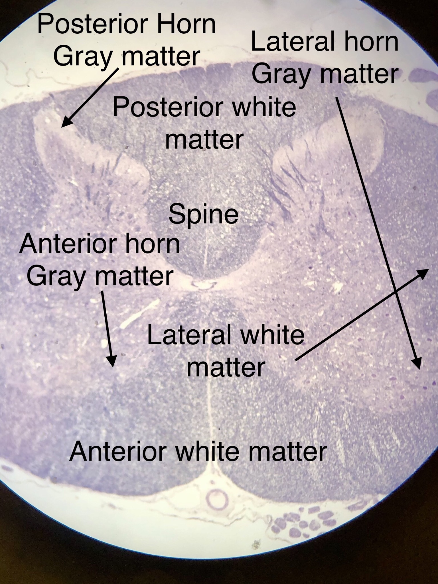 Pyramidal Neuron