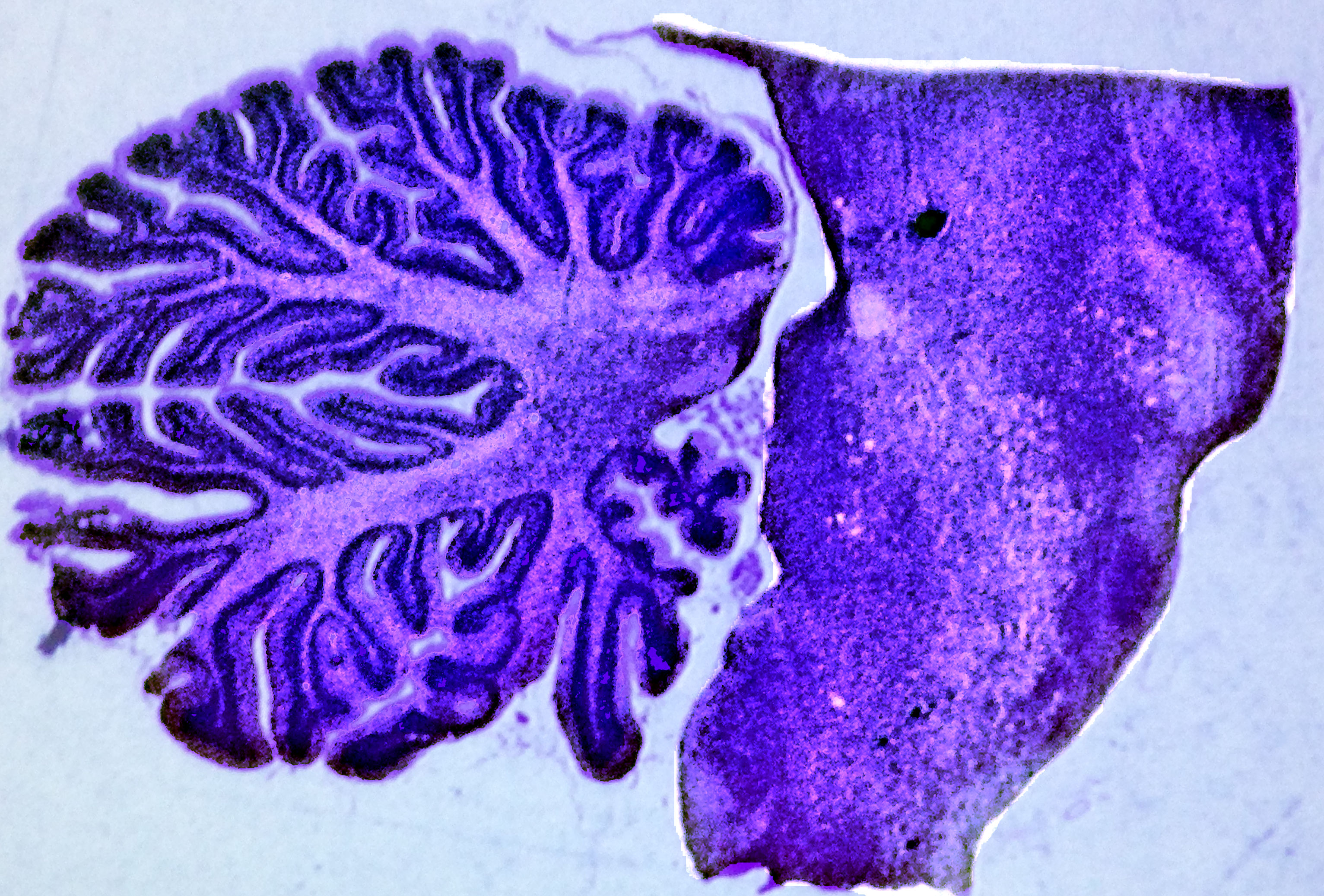 Brain Stem 