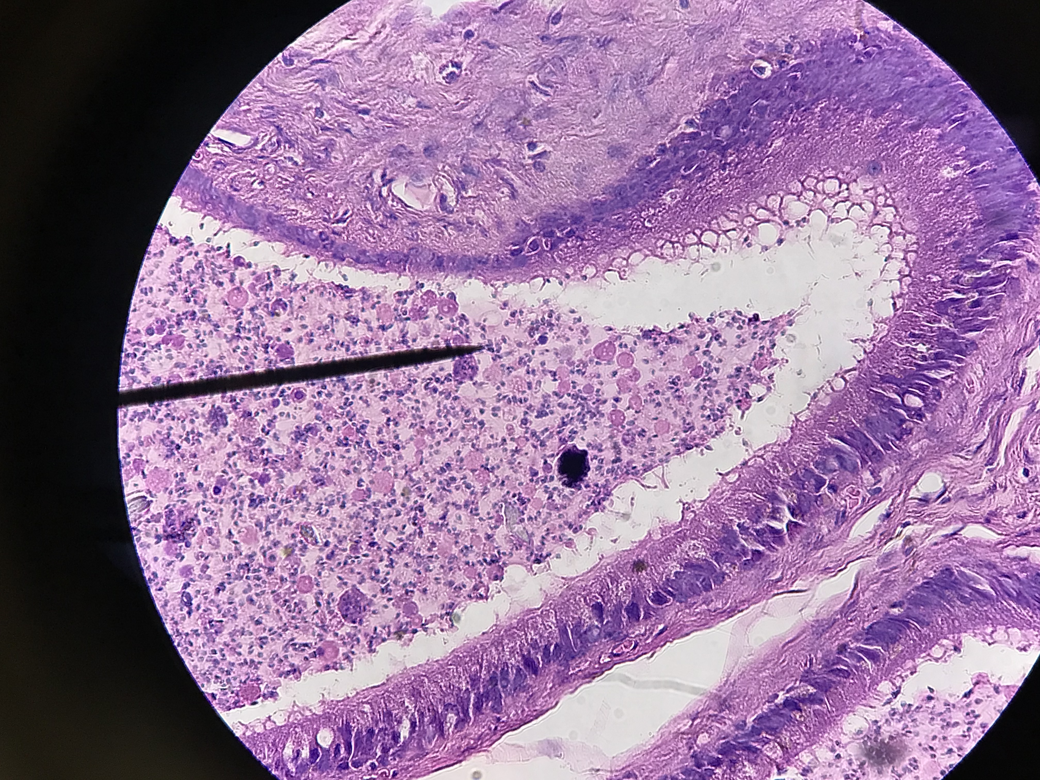 Epididymis