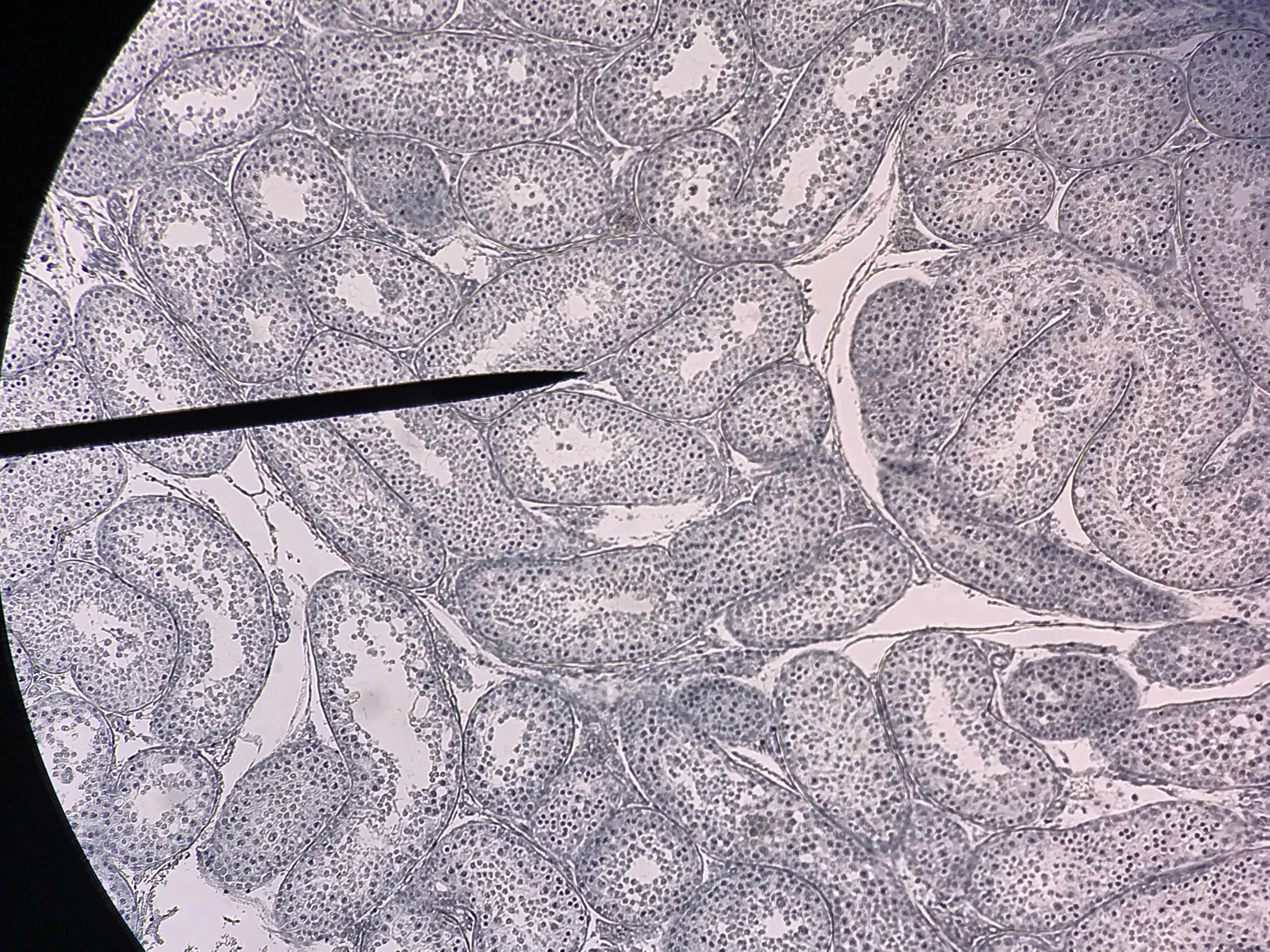 Seminiferous tubules