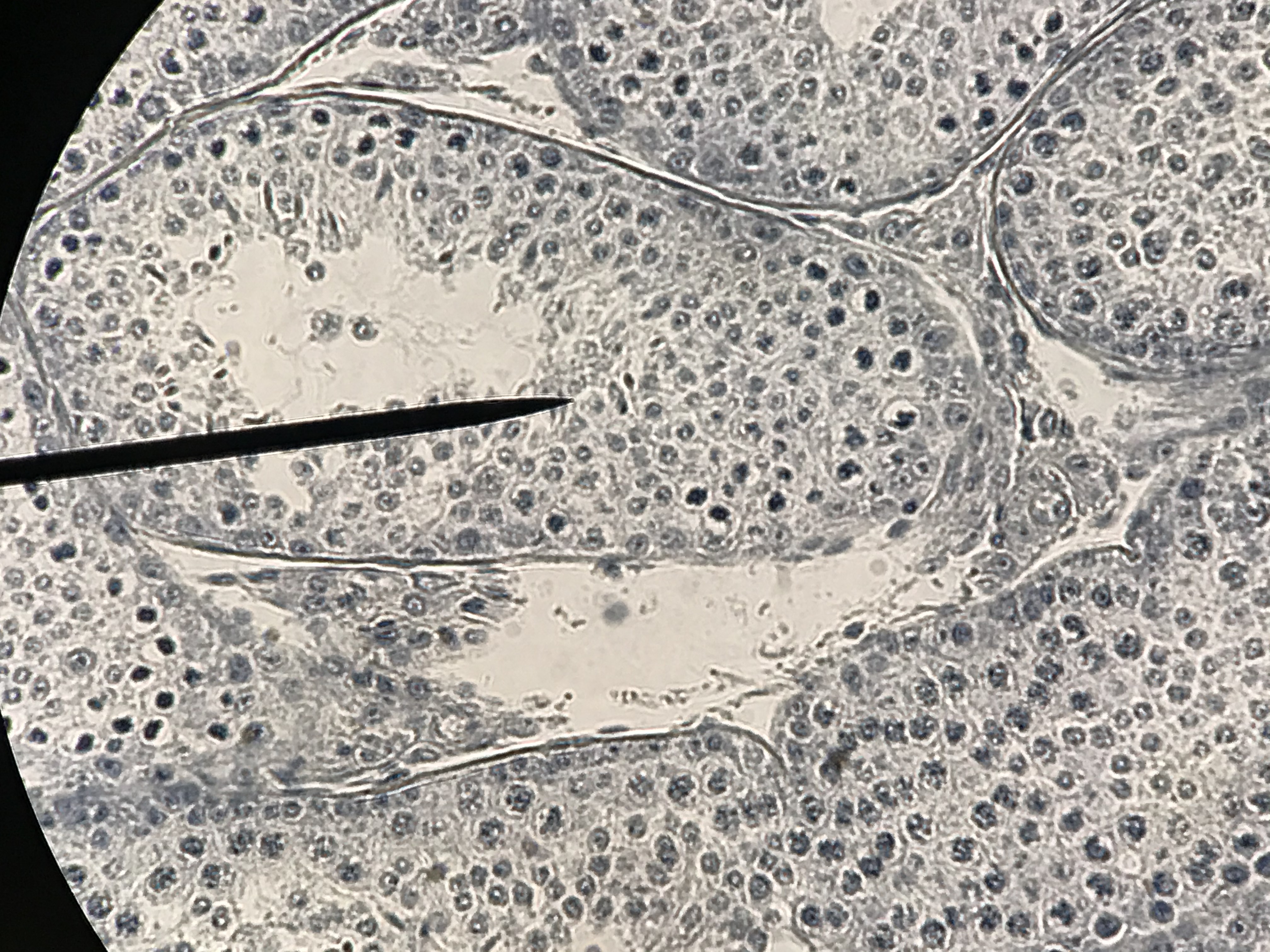 Seminiferous tubules