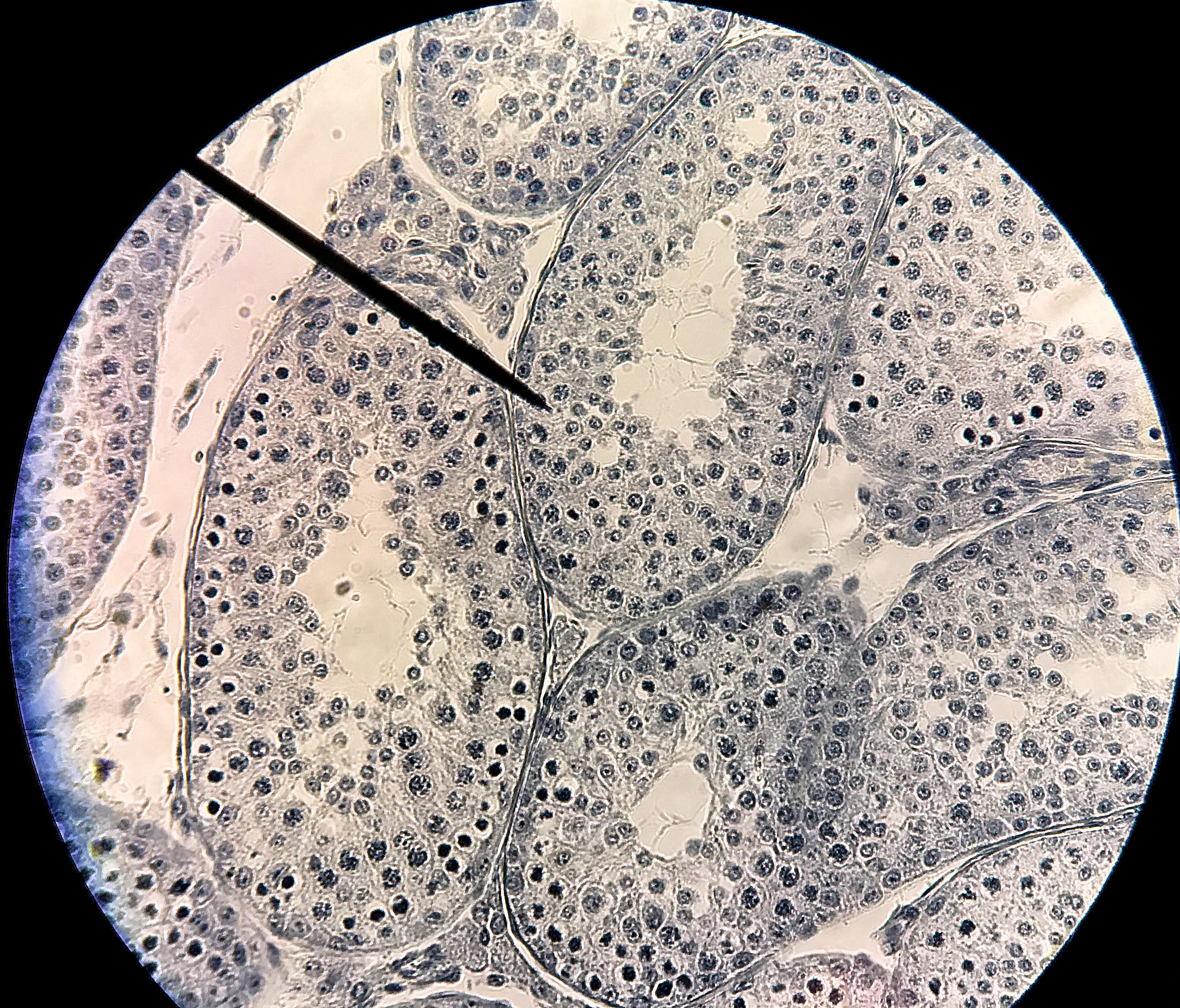 Seminiferous tubules