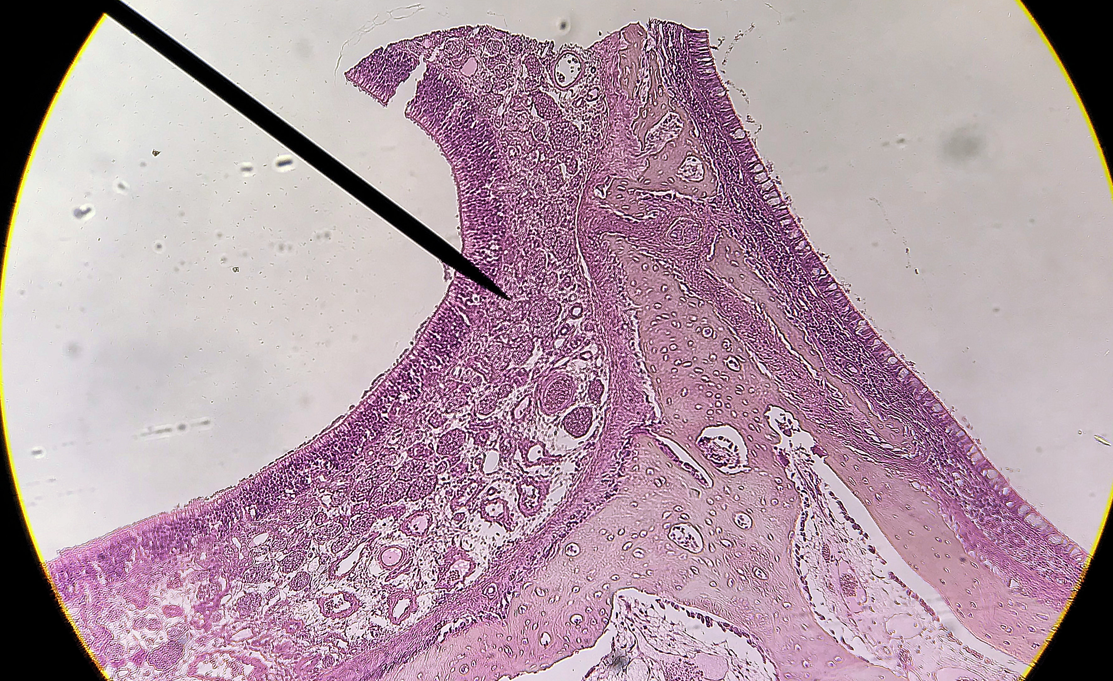 Nasal Epithelial