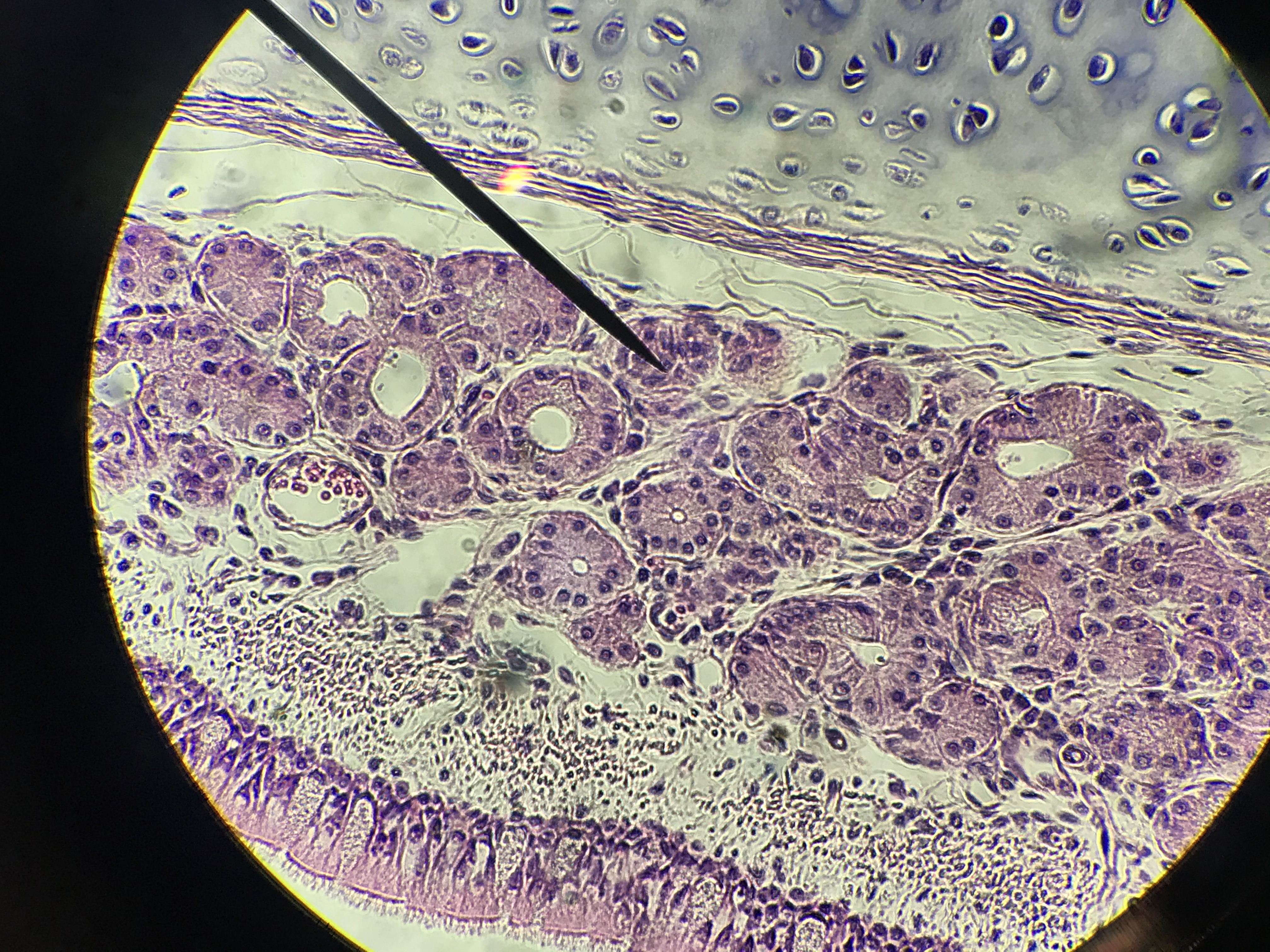 Tracheal