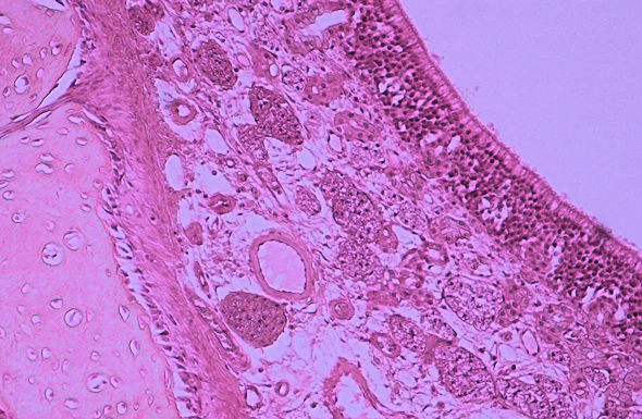 nasal epithelium