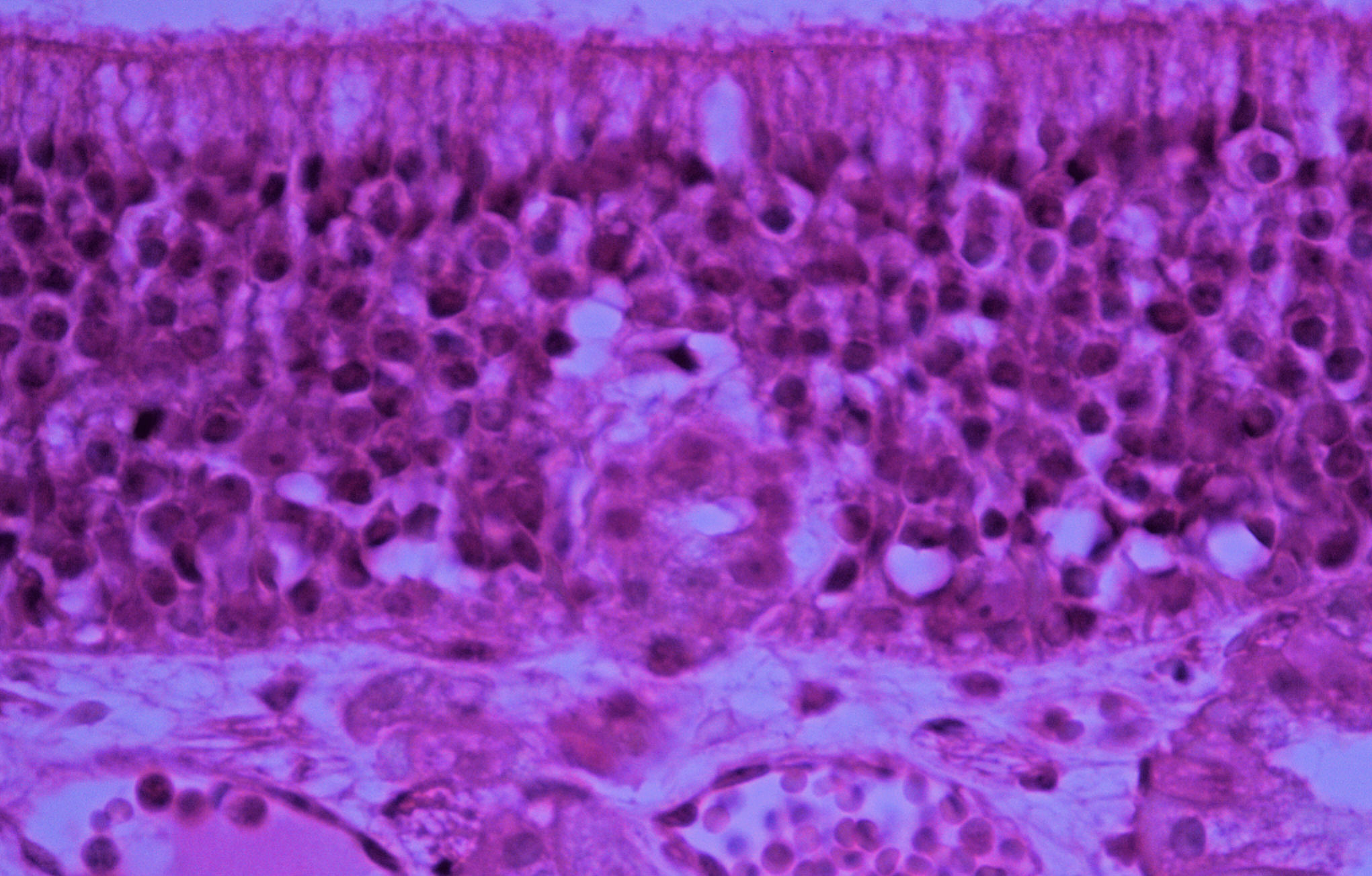 nasal epithelium