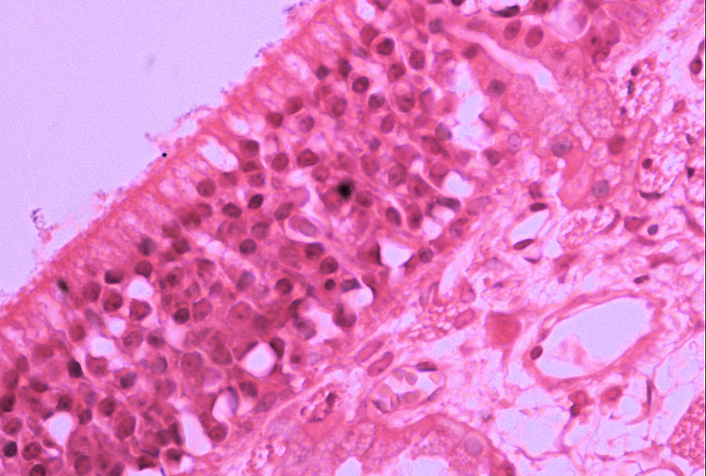 nasal epithelium