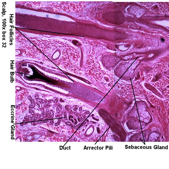 Labeled Picture