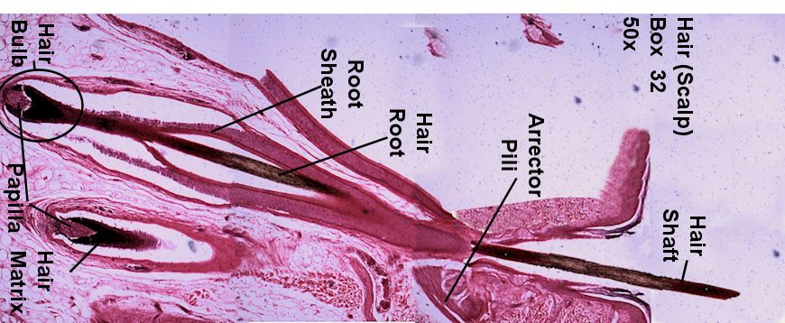 Labeled Picture