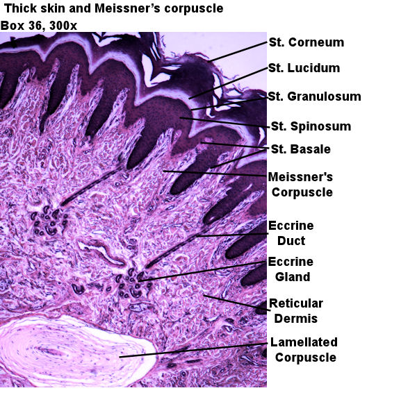 Labeled Picture