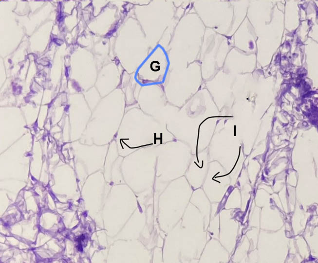 epithelial