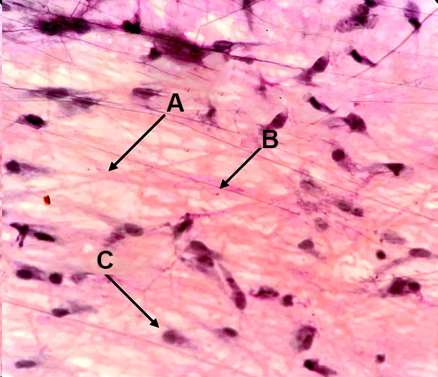 Random epithelial 7