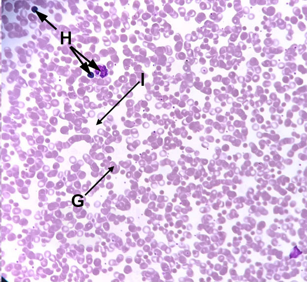 epithelial