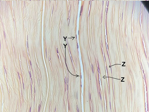 epithelial