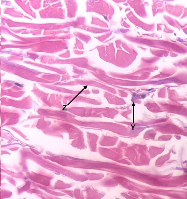 Random epithelial 7