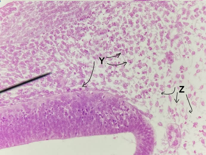 epithelial