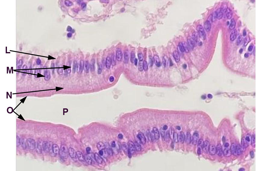 epithelial