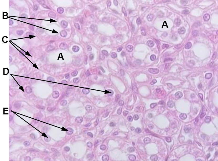 epithelial