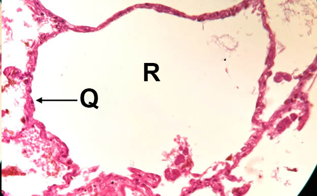 epithelial