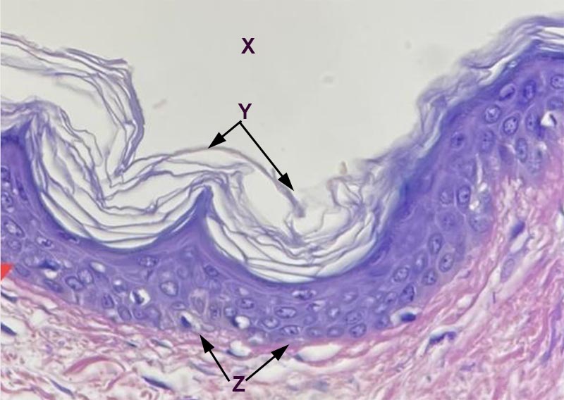 epithelial