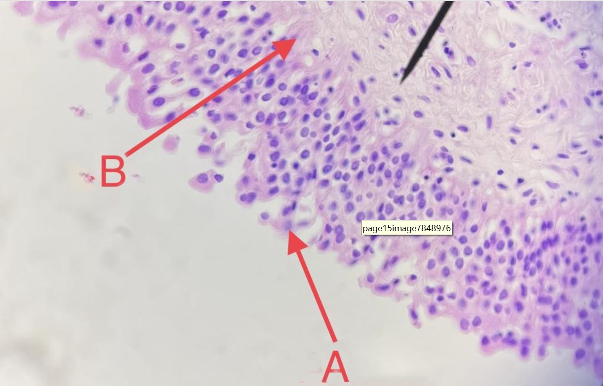 epithelial