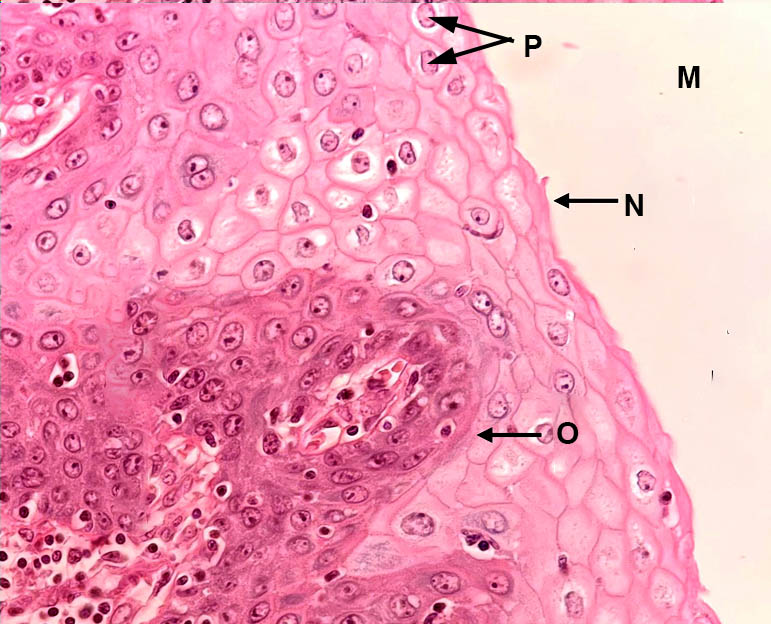 Random epithelial 7