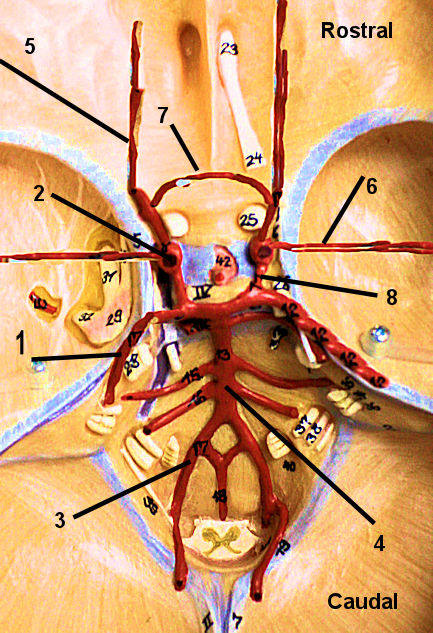 Circle of WIllis 3